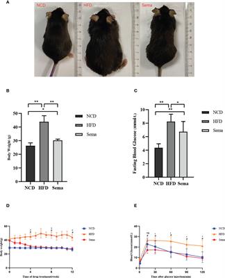 Effects of semaglutide on vascular structure and proteomics in high-fat diet-induced obese mice